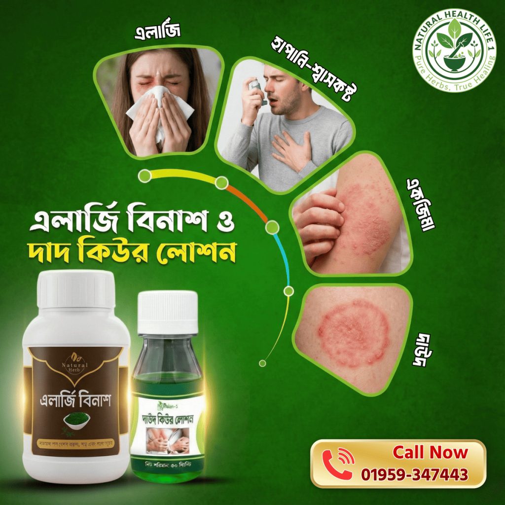Allergy Binus – Herbal Medicine Promotional Flyer Design